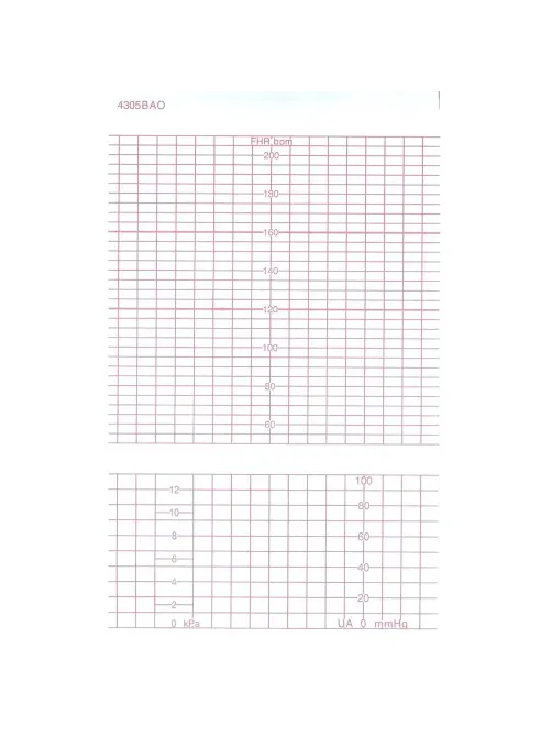 Лента тепл.регист. для CTG(FM) GE (COROMETRICS) BAO/DAO 151х90х150, K151Z90