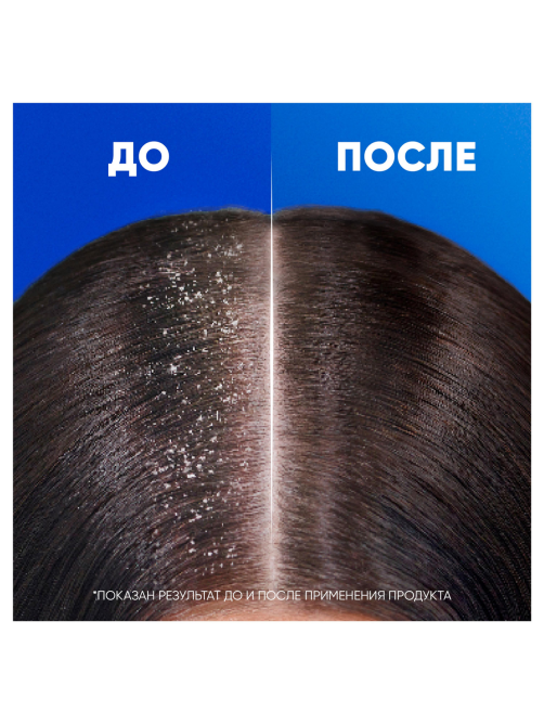 Шампунь Head & Shoulders Основной уход 2в1 против перхоти, 600мл