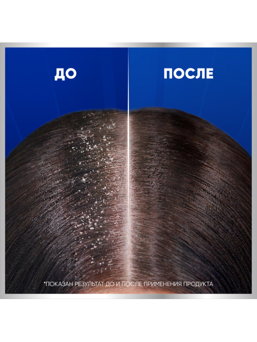 Шампунь Head & Shoulders Pro-Expert 7в1 мужской Снятие сильного зуда, 270мл