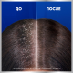 Шампунь Head & Shoulders Pro-Expert 7в1 мужской Снятие сильного зуда, 270мл