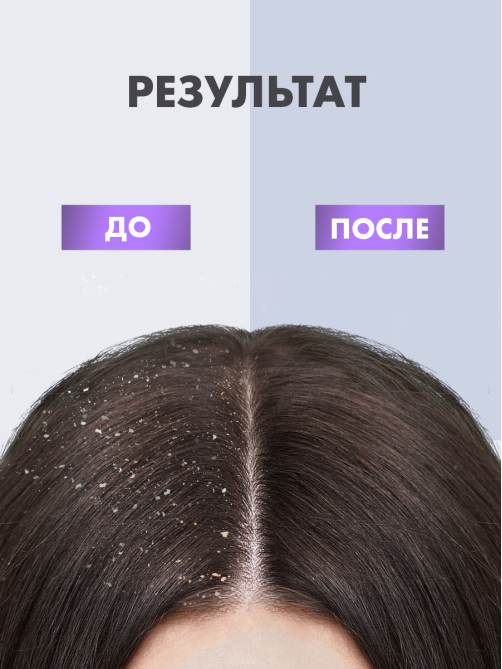 Шампунь Клиар Women 2в1 Антибактериальный эффект против перхоти, 380мл