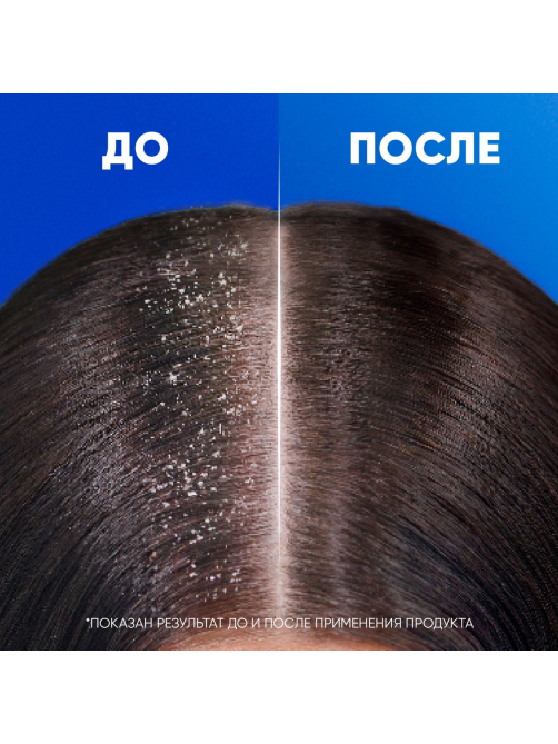 Шампунь Head & Shoulders против перхоти густые и крепкие, 800мл
