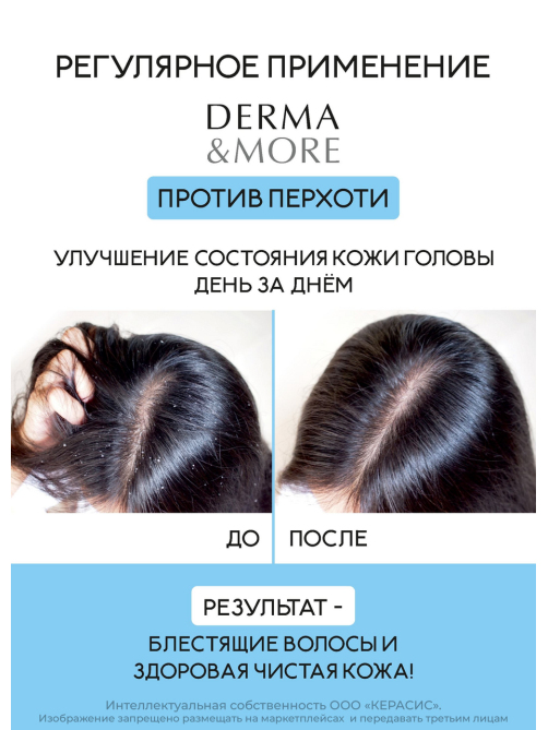 Шампунь Kerasys Derma & More от перхоти, 600мл