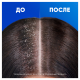Шампунь Head & Shoulders против перхоти алоэ вера, 360мл