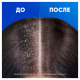 Шампунь-бальзам-ополаскиватель Head & Shoulders 2в1 Основной уход, 800мл
